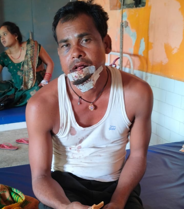 शादी समारोह से घर लौटते व्यक्ति पर हमला, सीएचसी दुद्धी में इलाज जारी